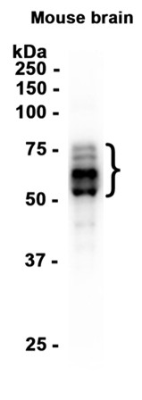 Phospho-Tau (Ser198) (YD13200) Rabbit mAb