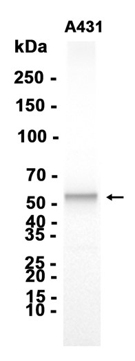 AYD15940