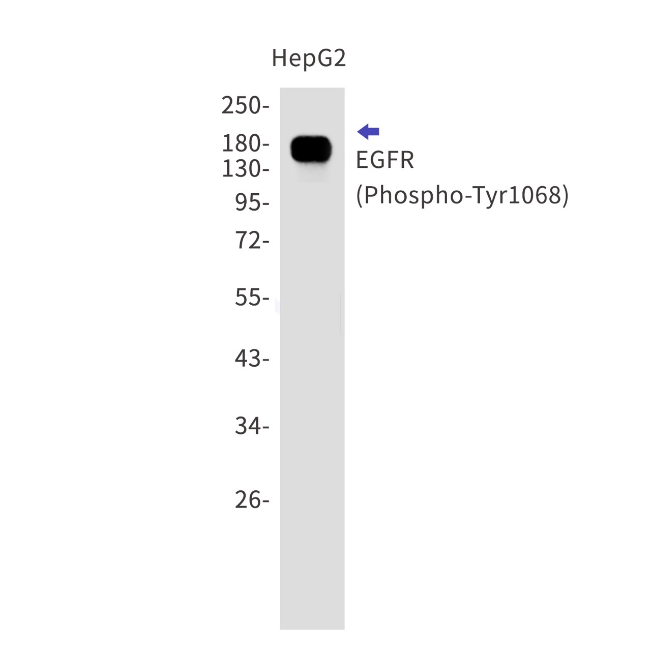 Phospho-EGFR (Tyr1068) (YD16903) Rabbit mAb