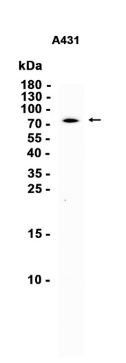 AYD13694