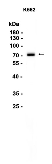 AYD15568