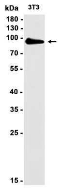 AYD11398