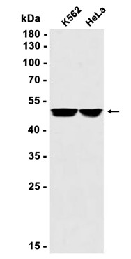 IKK gamma (YD14243) Rabbit mAb