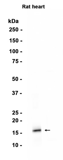 AYD15312