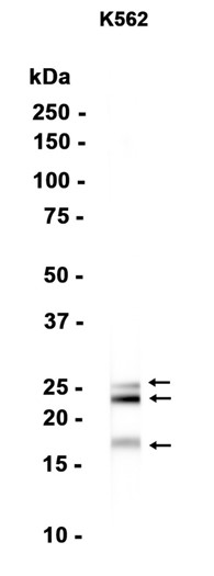 AYD14571