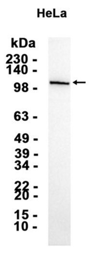 AYD15363
