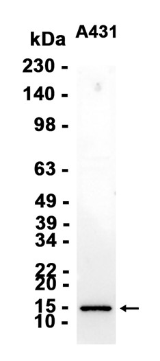 AYD15318