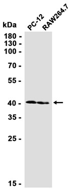 ADK (YD33090) Rabbit mAb