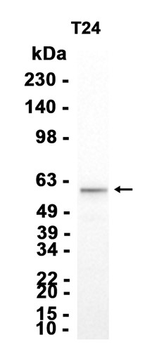 AYD13687