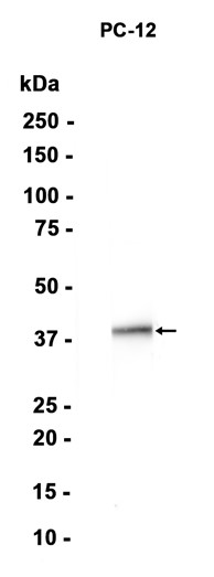 AYD13337