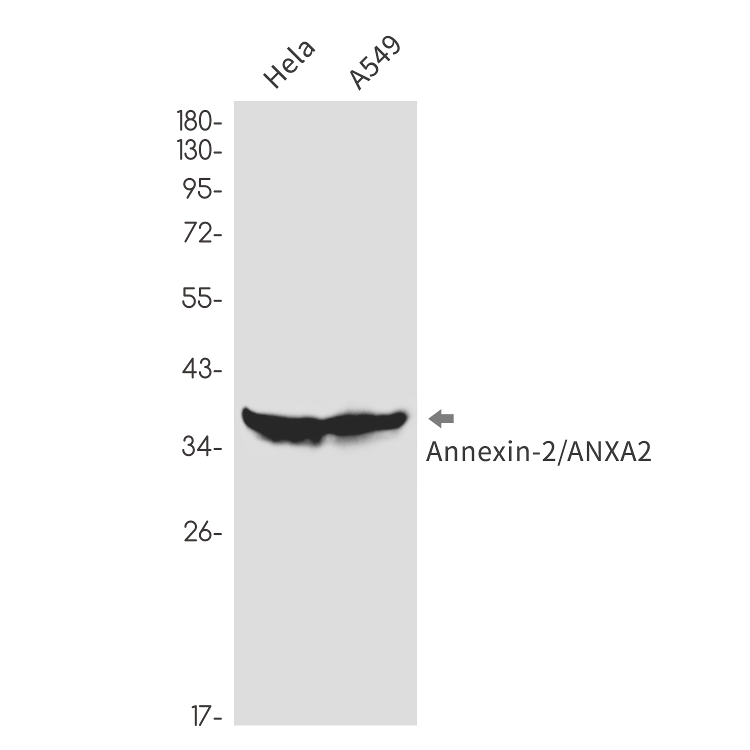 AYD14552