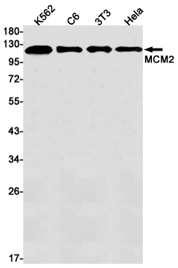 AYD11270