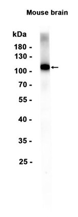 AYD15385