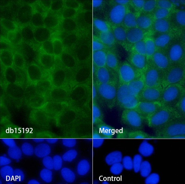 Flt3 ligand (YD14950) Rabbit mAb