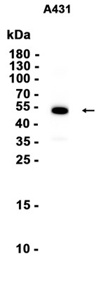 Cytokeratin 14 (YD32496) Rabbit mAb