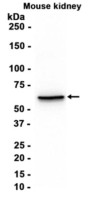 AYD11432
