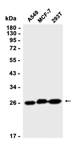 AYD13140