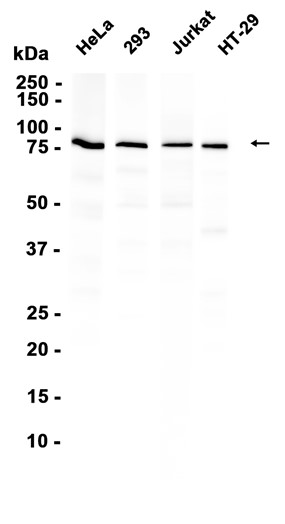 EIF2B5 (YD36298) Rabbit mAb