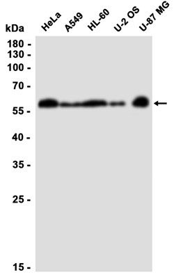 SQSTM1/p62 (YD34039) Rabbit mAb