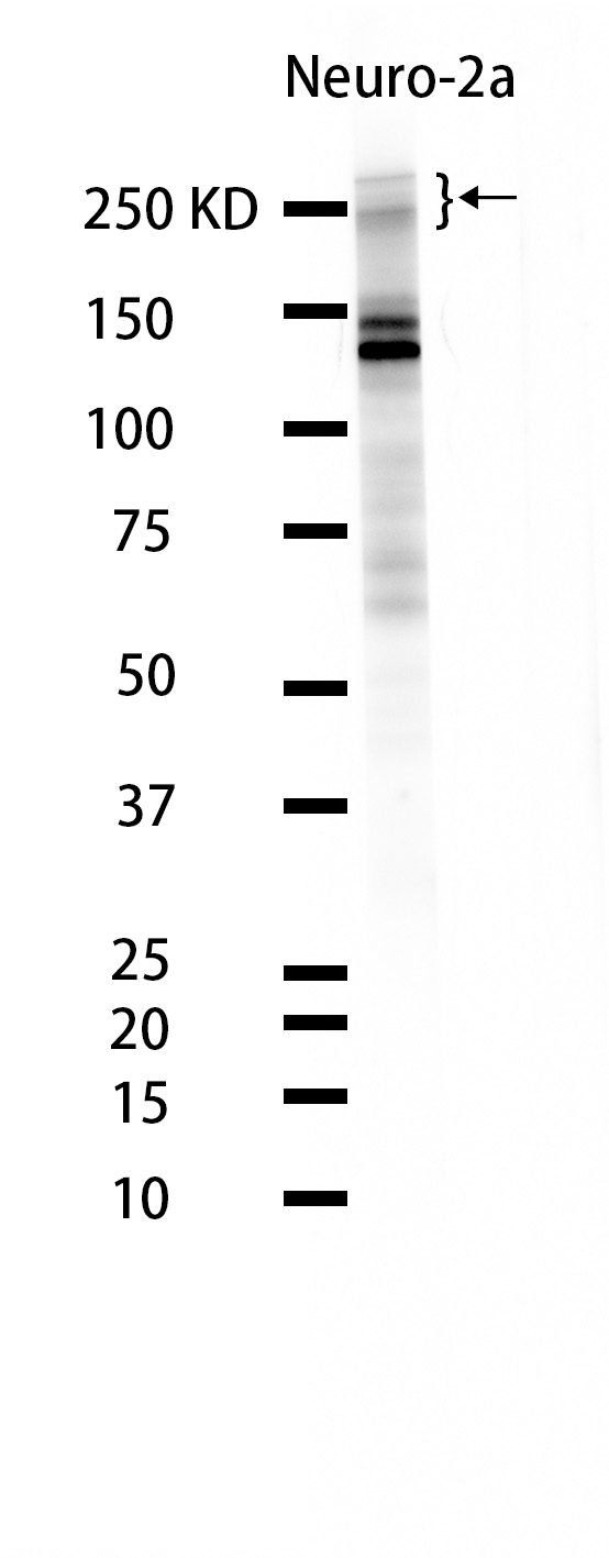 Nestin (YD31426) Rabbit mAb