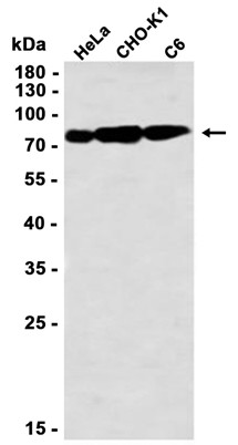 Phospho-Ezrin/Radixin/Moesin (Thr567/Thr564/Thr558) (YD20543) Rabbit mAb