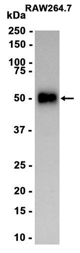 CD147 (YD11199) Rabbit mAb