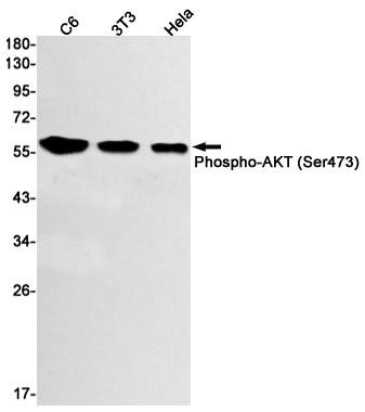 Phospho-AKT1 (Ser473) (YD12838) Rabbit mAb