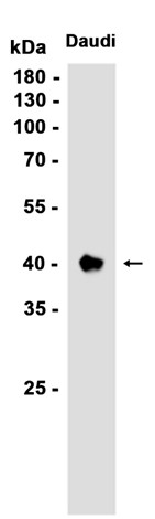 CD32 (YD17080) Rabbit mAb