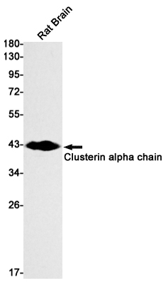 Clusterin alpha chain (YD15474) Rabbit mAb