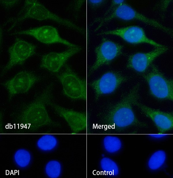 KRIT1 (YD16746) Rabbit mAb