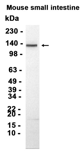 Integrin alpha 9 (YD14505) Rabbit mAb