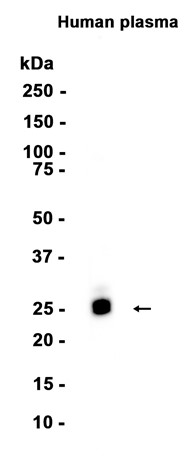 AYD11135