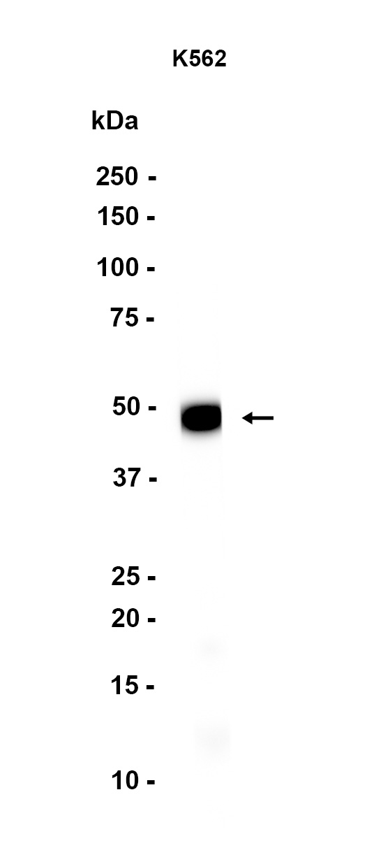 TGF beta 1/3 (YD11638) Rabbit mAb