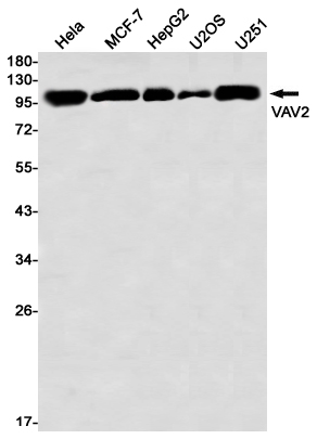 AYD11417