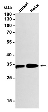 ZNF364 (YD11390) Rabbit mAb