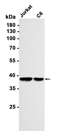 AYD11313