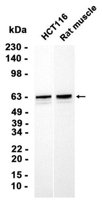 AYD11455