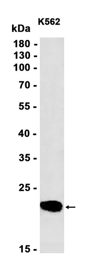 AYD11604