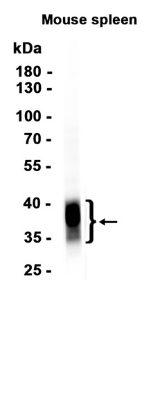 CD8 alpha (YD14754) Rabbit mAb