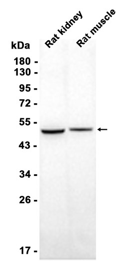 AYD14277