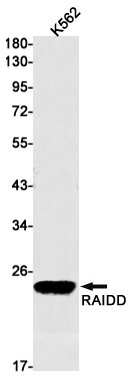 AYD12283