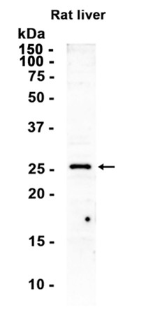 TNF alpha (YD19238) Rabbit mAb