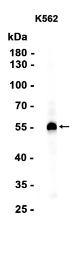 AYD15362