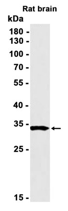 DARPP32 (YD13959) Rabbit mAb