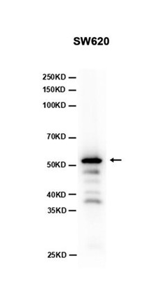 Phospho-p53 (Ser392) (YD11144) Rabbit mAb