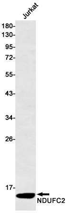AYD14199