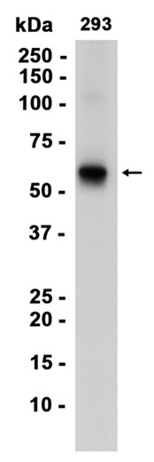 AYD14981