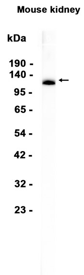 AYD14171