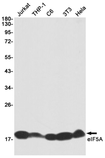 eIF5A (YD31192) Rabbit mAb