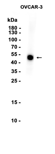 AYD11862